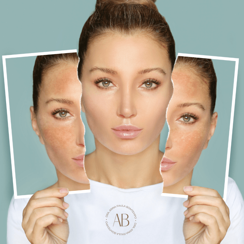 Explicação sobre a estrutura da pele, as diferenças entre pele branca e negra, a importância da fotoproteção e a relação entre saúde da pele e bem-estar emocional.