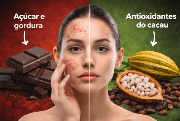 Chocolate causa espinhas? Veja o impacto desse doce na pele